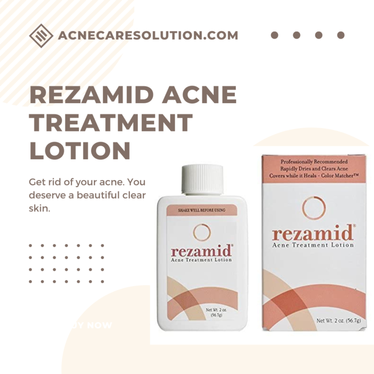 rezamid acne treatment lotion: Affordable acne Solution
