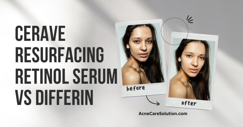 Cerave Resurfacing Retinol Serum Vs Differin