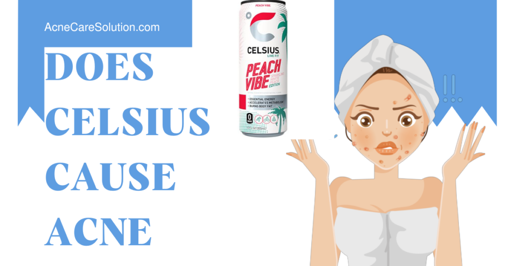 Does Celsius cause acne